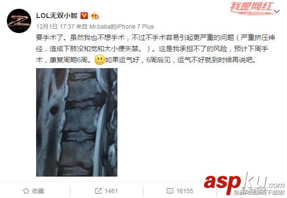 lol小智,lol小智手術,lol小智怎么了,lol小智怎么沒直播了