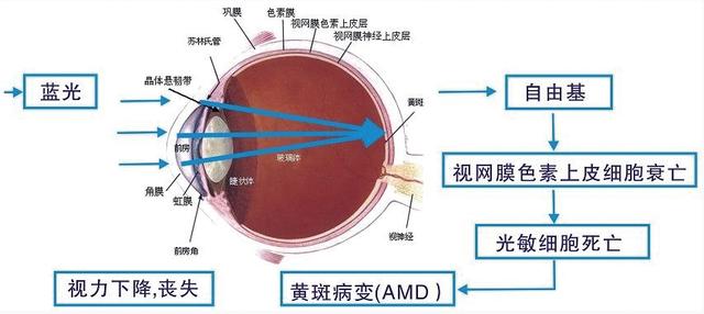 護眼顯示器真護眼嗎 護眼顯示器有用嗎