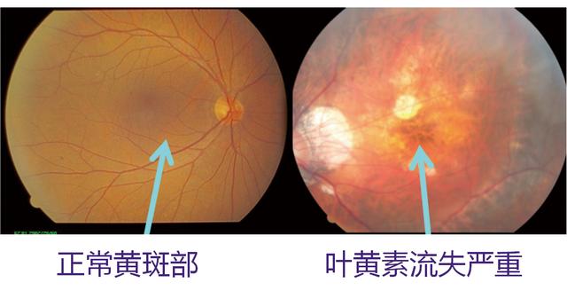 護眼顯示器真護眼嗎 護眼顯示器有用嗎