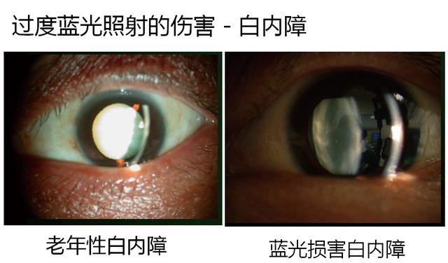 護眼顯示器真護眼嗎 護眼顯示器有用嗎