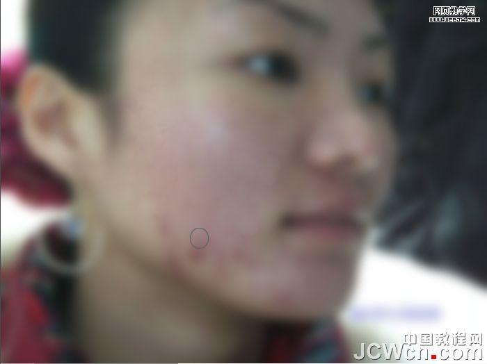 練就網絡美女 ps完美除痘痘磨皮教程_網頁設計