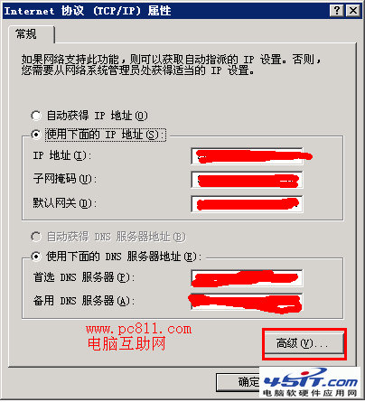 TCP/IP篩選開啟和關閉方法